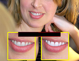 �������X�V�RImage Trends PearlyWhites 2.10ע�԰�